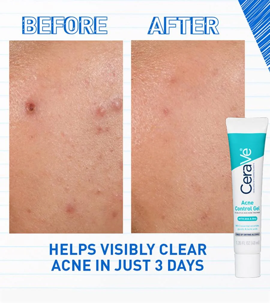 CeraVe Acne Control Gel - Image 4